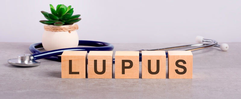 ¿Qué es el lupus y cuáles son sus síntomas?