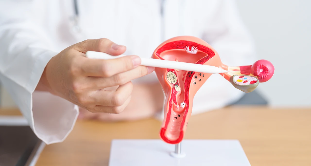 Descubre la relación entre endometriosis y fertilidad