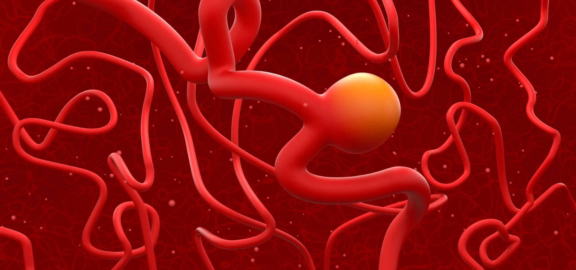 banner ¿Qué es un aneurisma cerebral y cuándo es una emergencia_ indisa