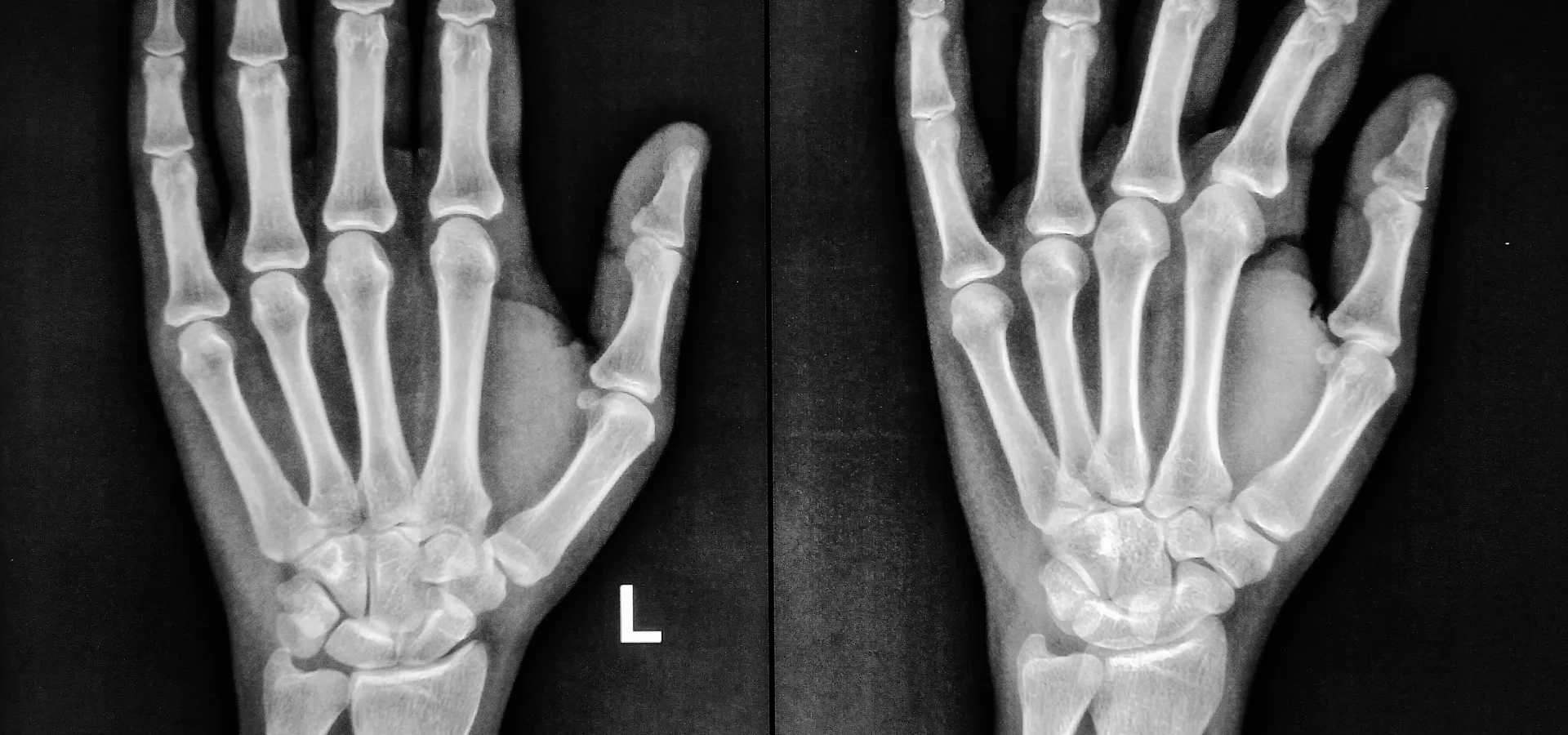 nota Centro de Cirugía de Mano y Microcirugía de alta complejidad