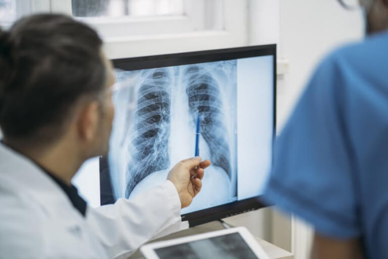 Doctor revisando radiografia de pulmones del paciente