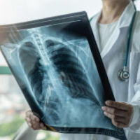 Radiografía traumatología