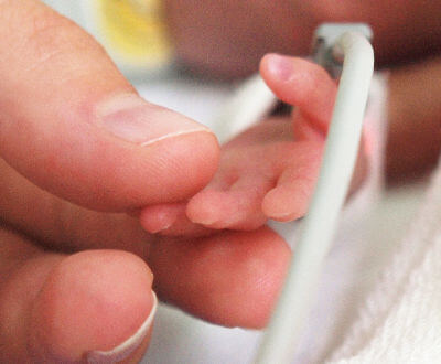 mano de adulto tomando la mano de un bebé prematuro
